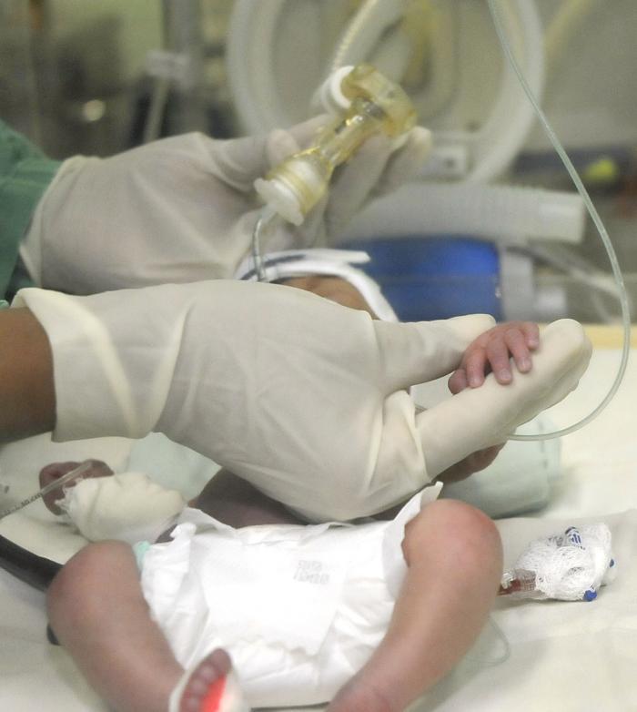 Centro de InmunoEnsayo inició la producción de nueva prueba para la pesquisa neonatal en Cuba